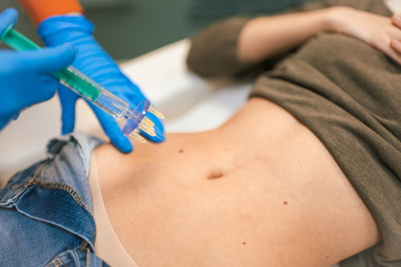 Moderne Körperbehandlungen mit anti fett spritze bei MorySkin
