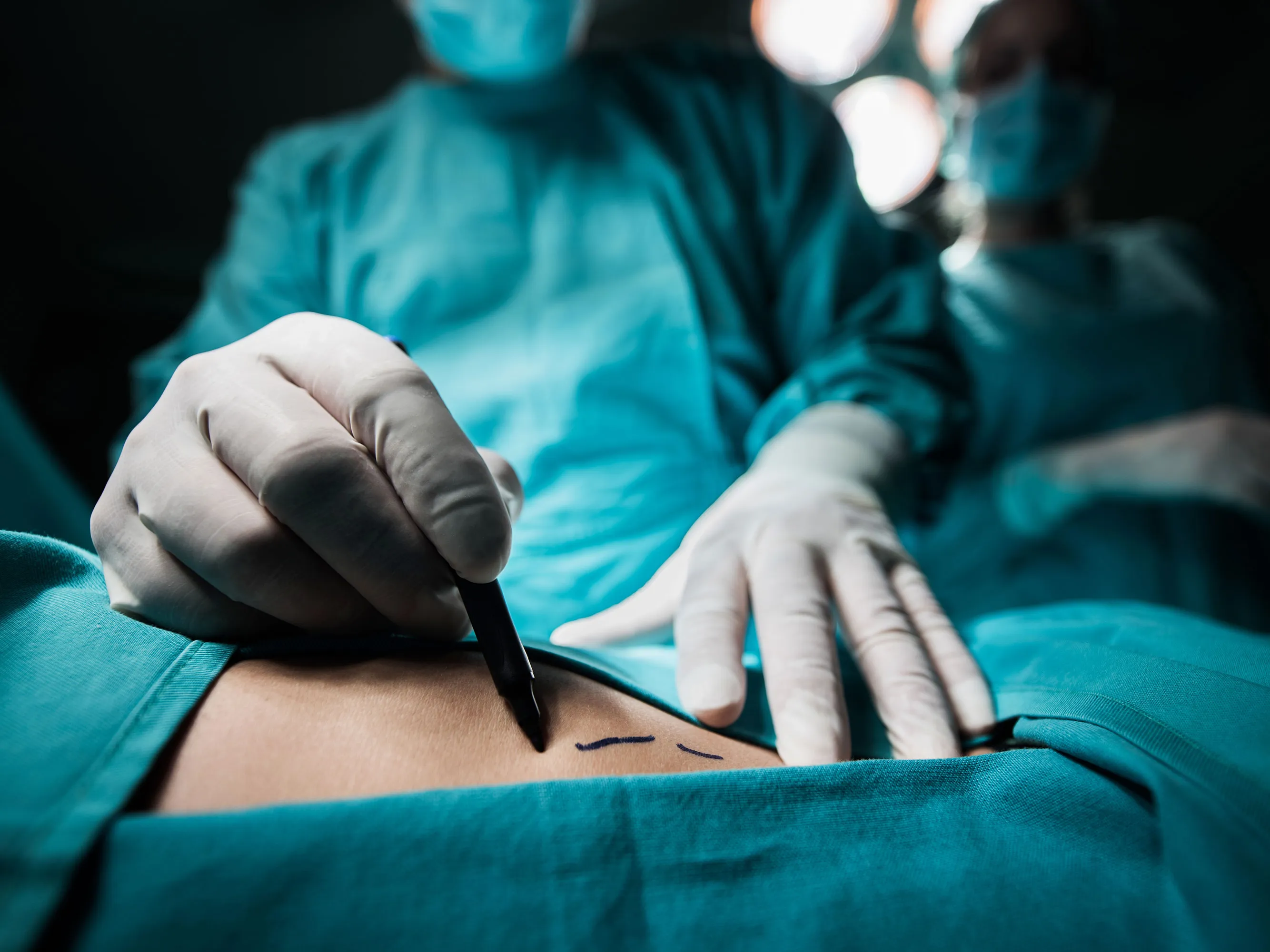 Brustvergrößerung mit Eigenfett: Die sichere Alternative für mehr Volumen